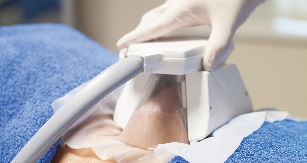 How Fat Freezing and HIFU Work Together? 2 Multiple Areas in One Session HIFU and Fat Freezing Sevenoaks