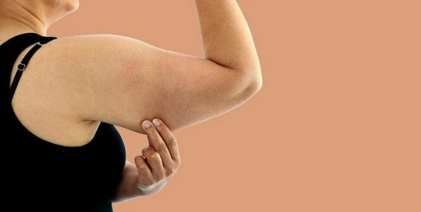Toning Bingo Wings Sevenoaks Effective Exercises and Tips for Achieving Sleeker Arms