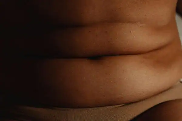 The Hidden Connection: How Stress Shapes Your Fitness and Body Composition 3 image of what stress can do on the stomach area and how Lipo 360 Sevenoaks can help to change your body shape.